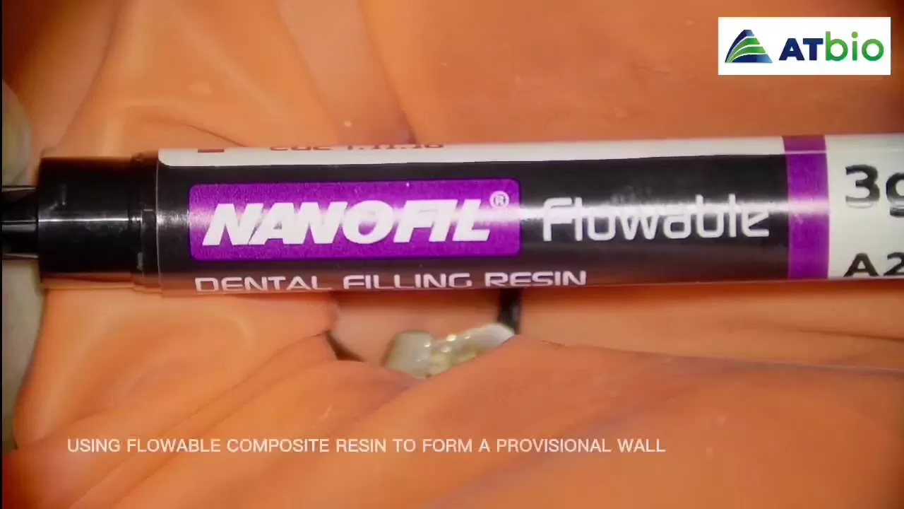 NANOFIL | Flowable Light-Cured Composite Resin | Clinical Applications