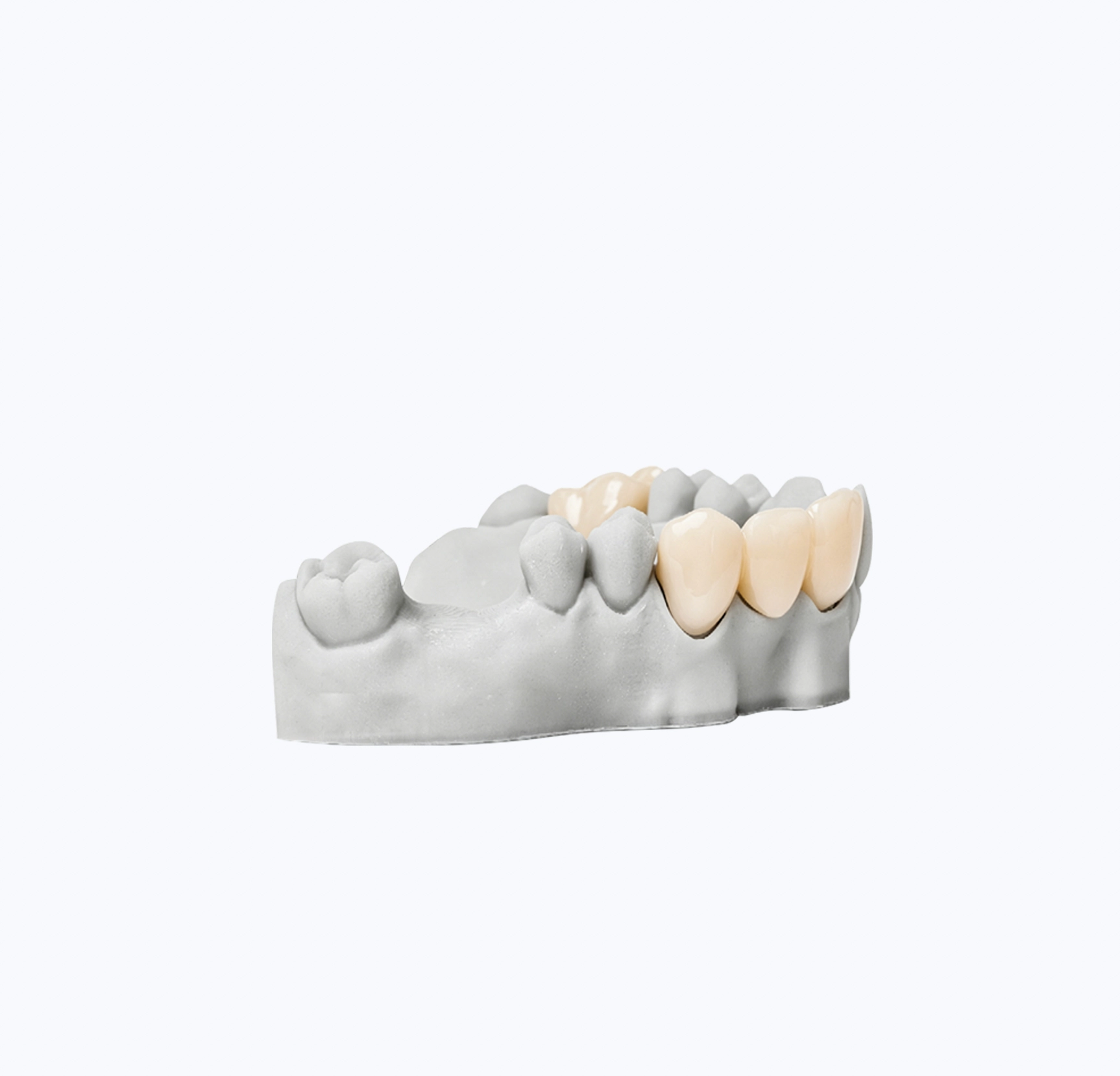 NANOFIL® Temporary Crowns & Bridges 3d Printing Material